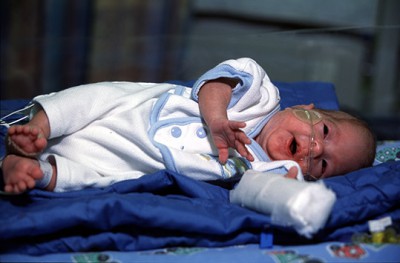 Premature-Infant